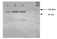 ACC synthase 7 | 1-aminocyclopropane-1-carboxylate synthase 7 in the group Antibodies Plant/Algal / Hormones / Biosynthesis/regulation at Agrisera AB (Antibodies for research) (AS14 2774)